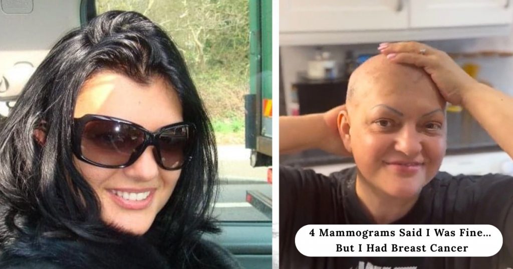 4 mammograms said i was fine… but i had breast cancer